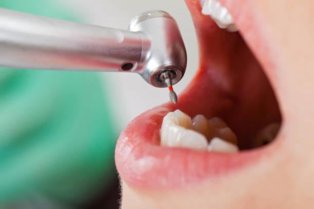 Best Tooth Pain Emergency Relief  in Cedar Creek, TX
